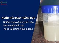 Nước Tiểu Đục Trắng Là Bệnh Gì